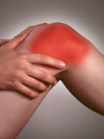Артроз коленного сустава – лечение народными средствами