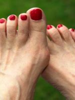 Как лечить подагру на большом пальце ноги?