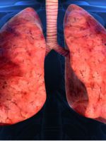 Туберкулез – симптомы, первые признаки всех форм и видов коварного недуга