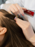 Плазмолифтинг для волос – все, что нужно знать о процедуре