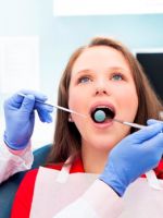 Флюороз зубов – причины и лечение всех видов болезни
