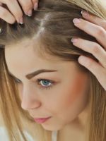 Очаговая алопеция – почему развивается гнездное выпадение волос, и как с этим бороться?