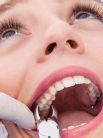 Что делать после удаления зуба и как ускорить заживление?