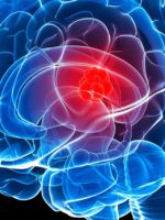 Менингиома головного мозга – причины, лечение опухоли, прогноз жизни