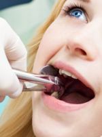 Ретинированный зуб – признаки и современные методы лечения