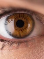 Что такое склеропластика глаз, для чего и как проводят операцию?