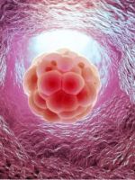 Имплантация эмбриона – признаки начинающейся беременности