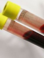 Сдача крови для анализов и донорства – важные правила подготовки