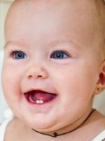Прорезывание зубов у детей – порядок, сроки и симптомы