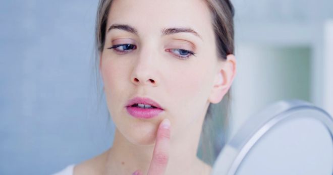 Герпес на лице – виды высыпаний и самые эффективные способы лечения