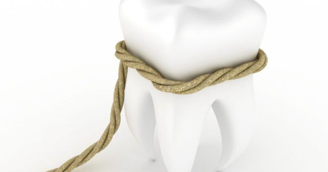 Удаление зуба – все, что нужно знать о процедуре