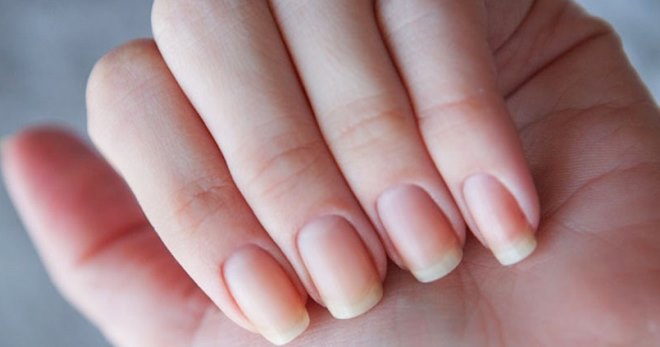 Гранулема ногтя – 4 главных причины и лучшие способы лечения