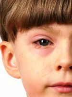 Чем промывать глаза при конъюнктивите у детей?