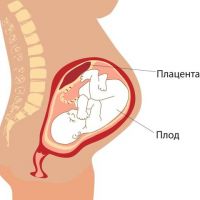 толстая плацента при беременности