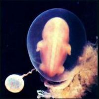 когда на узи видно эмбрион