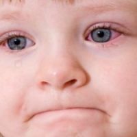 красные белки глаз у ребенка