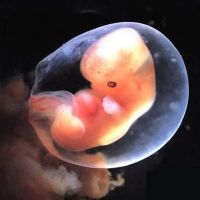 не визуализируется эмбрион
