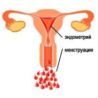 почему происходит сбой менструационного цикла