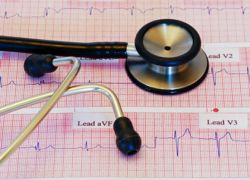 инфаркт миокарда симптомы и последствия