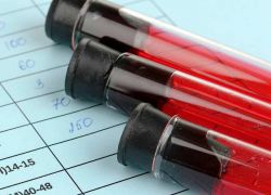анализ крови мочевая кислота норма у женщин