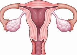 непроходимость маточных труб и беременность