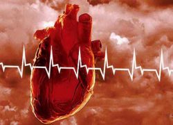 признаки кардиомиопатии