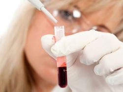 в12 дефицитная анемия анализ крови