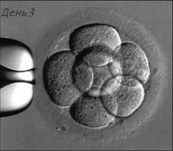 перенос эмбрионов на 3 день