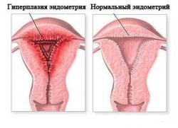 размер эндометрия при беременности
