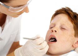 Герметизация зубов у детей
