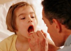 лечение тонзиллита у детей