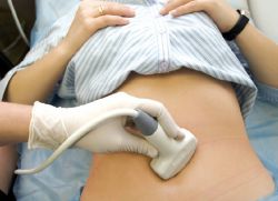 вероятность забеременеть после внематочной беременности