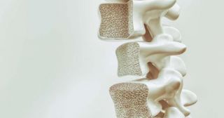 5 эффективных способов профилактики и лечения остеопороза