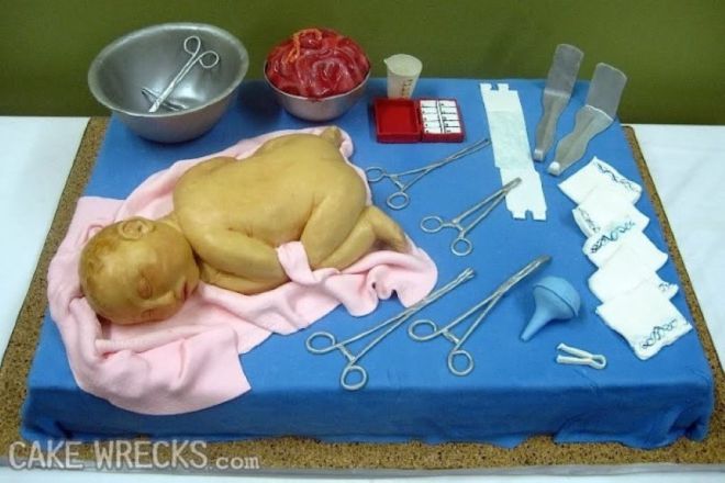 Младенец на хирургическом столе
