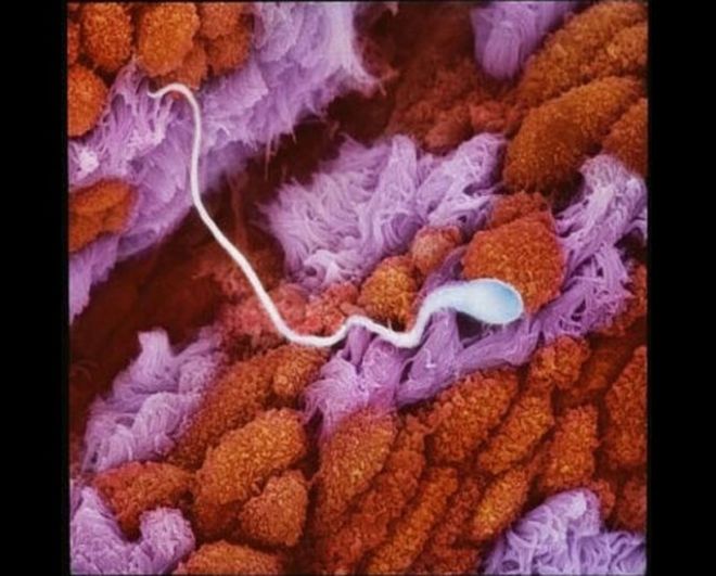 Попадание сперматозоида в маточную трубу