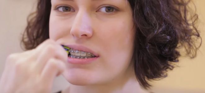 Как чистить зубы с брекетами зубной щеткой второй