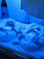 Фототерапия для новорожденных