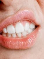 Отбеливание зубов народными средствами