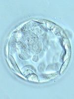 Замораживание эмбрионов
