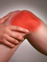 Артроз коленного сустава 3 степени – лечение