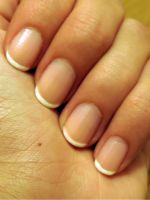 Полоски на ногтях – причины