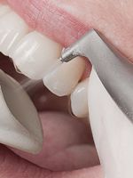 Чистка зубов Air Flow – что это такое?