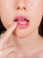 Рак губы – симптомы, первые признаки