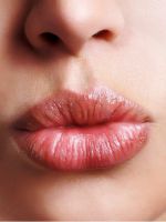 Герпес на губах – быстрое лечение