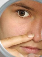 Внутренний прыщ в носу – как лечить?