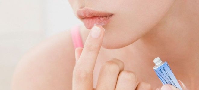 Лечение заедов в уголках губ лекарства