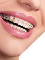 Как чистить зубы с брекетами – советы ортодонтов