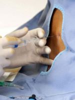 Эпидуральная анестезия при кесаревом сечении – все особенности обезболивания