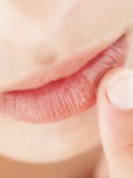 Почему трескаются губы и как быстро справиться с проблемой?