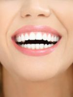 Что такое виниры в стоматологии - сколько стоит красивая улыбка?